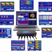 Curso Completo: Técnico de Neurometria - Promoção de Final de Ano